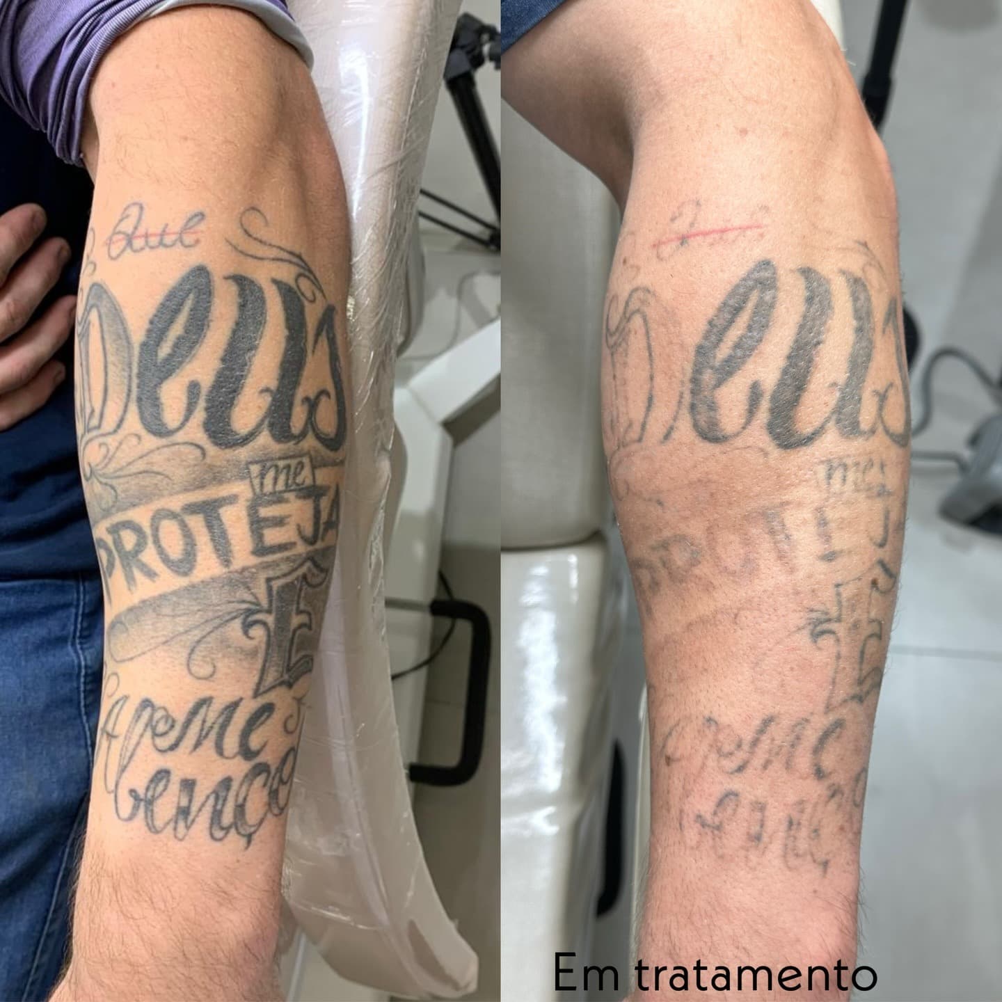 Resultado Clínico 31 - Dr Jacson