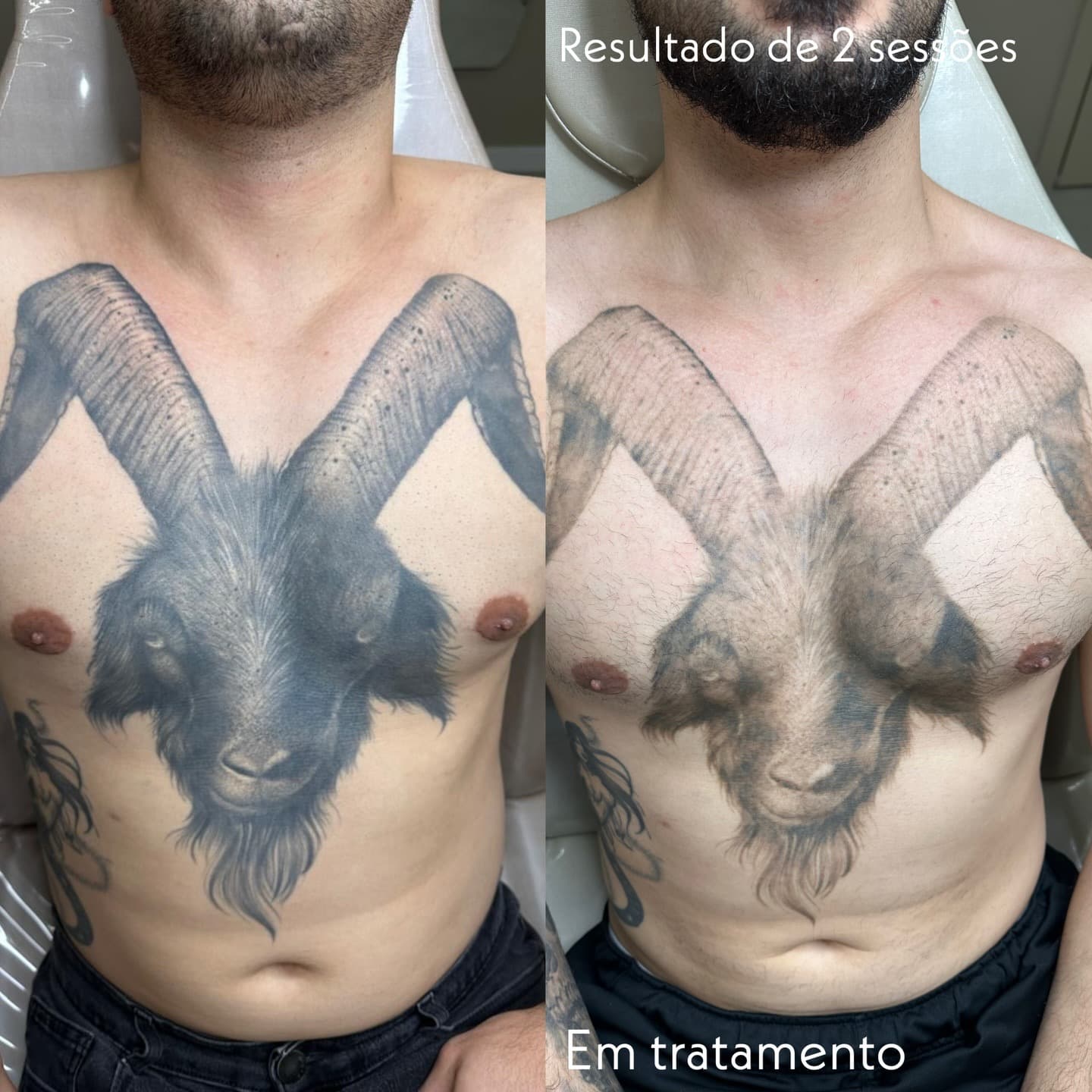 Resultado Clínico 32 - Dr Jacson