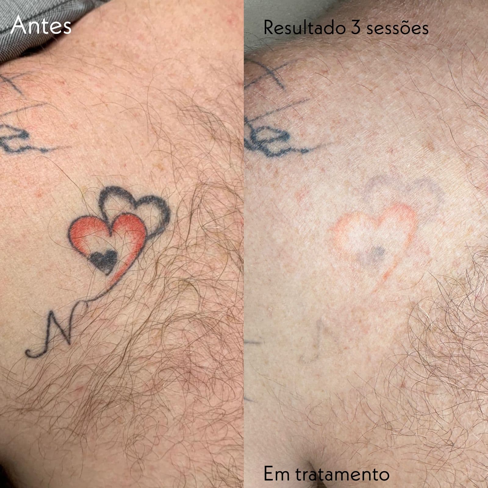Resultado Clínico 5 - Dr Jacson